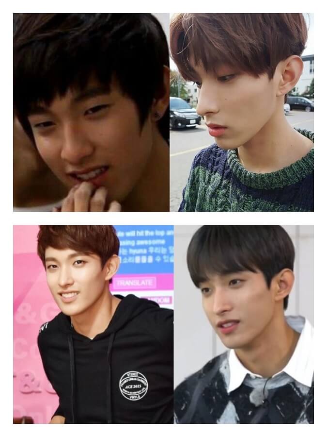 DK (Before After)