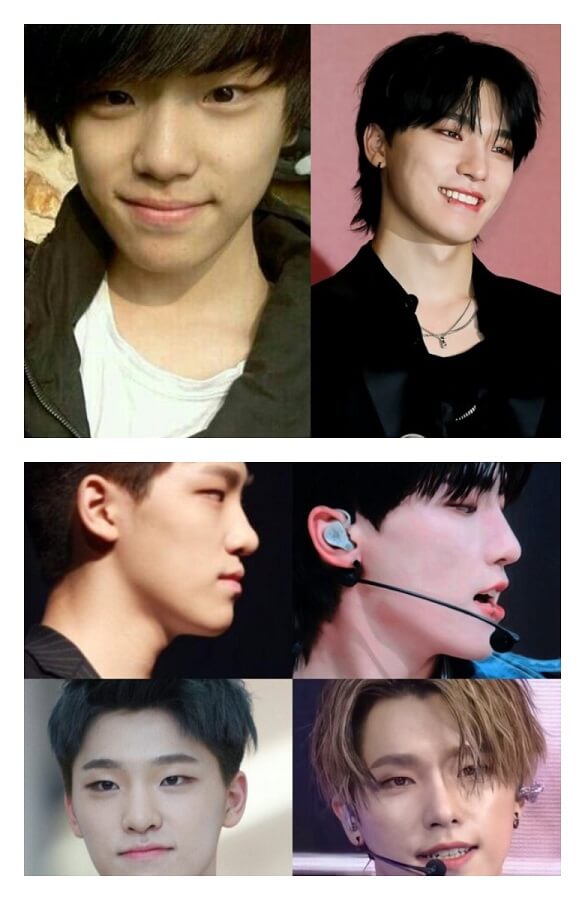 Dino (Before After)