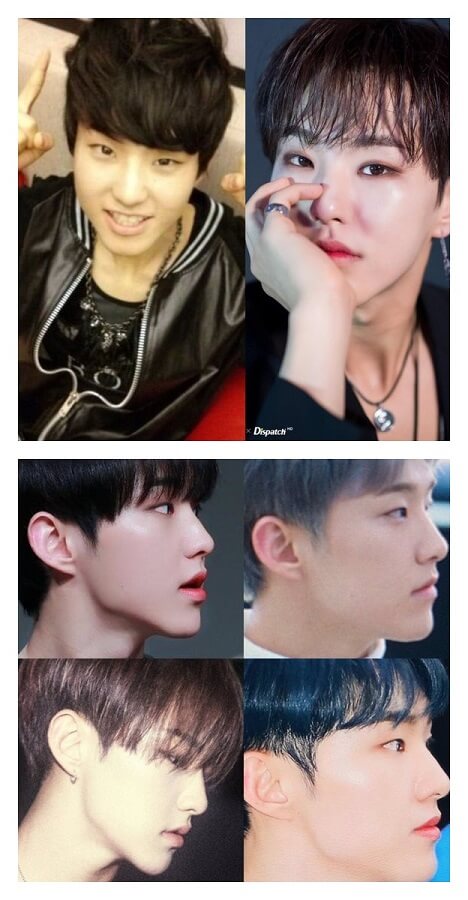Hoshi (Before After)