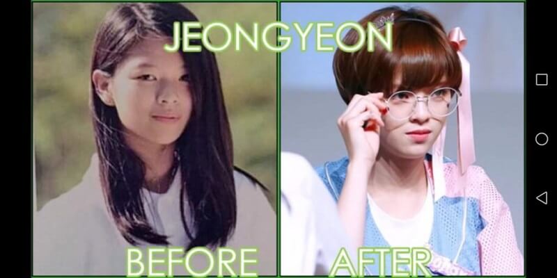 Jeongyeon before after plastic surgery