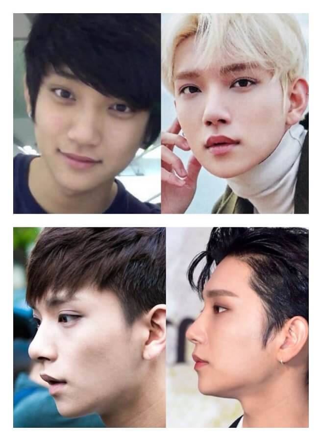 Joshua (Before After)