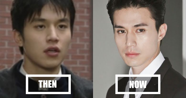 Lee Dong Wook Plastic Surgery Before and After Pictures