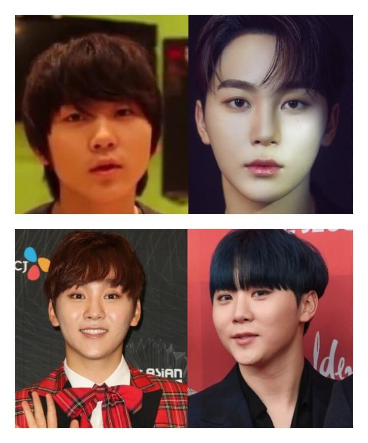 Seungkwan (Before After)