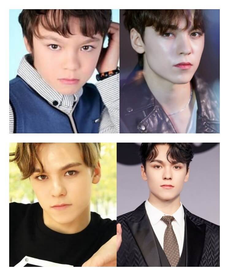 Vernon (Before After)