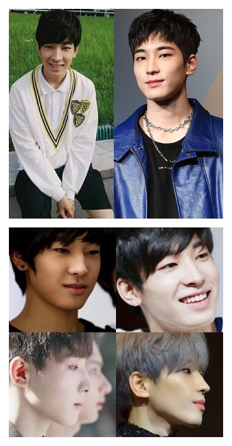 Wonwoo (Before After)