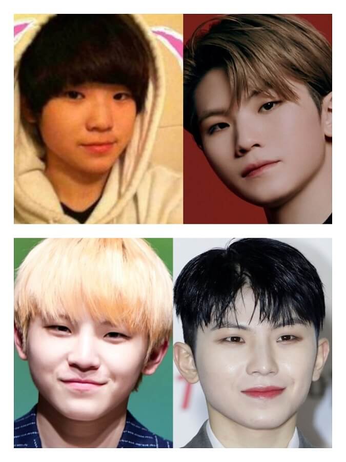 Woozi (Before After)