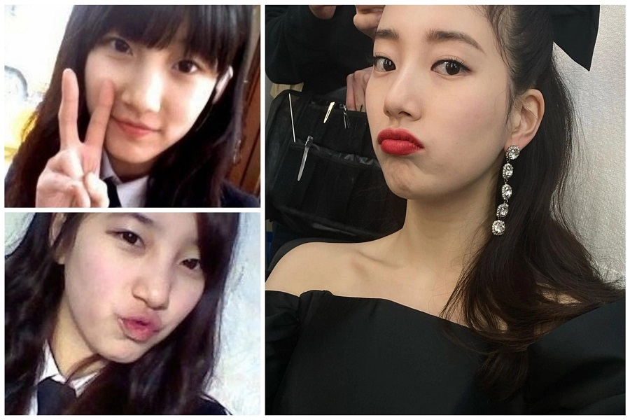 Bae Suzy Plastic Surgery