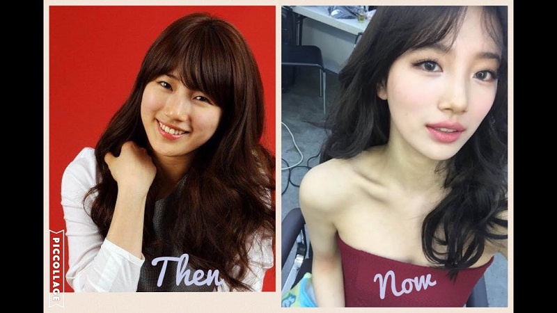 Let’s Take a Look at Before & After of Suzy’s Face!