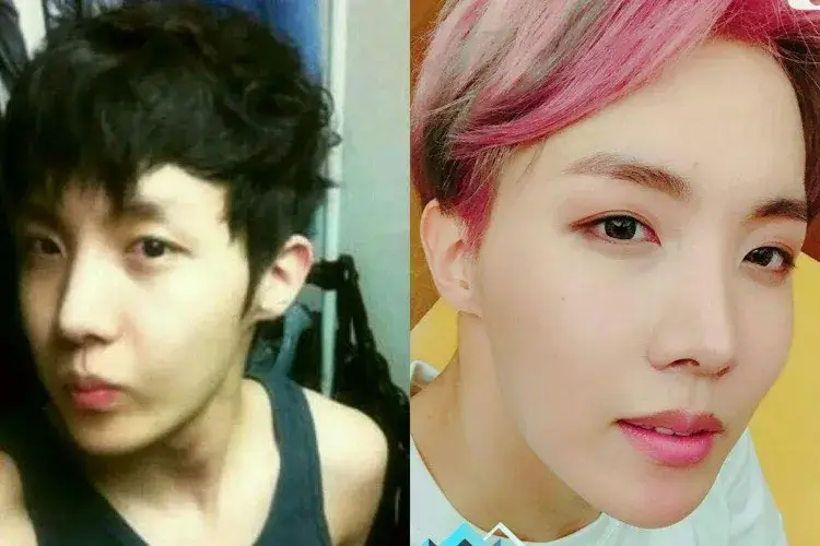 BTS' J-Hope Plastic Surgery (Before and After)