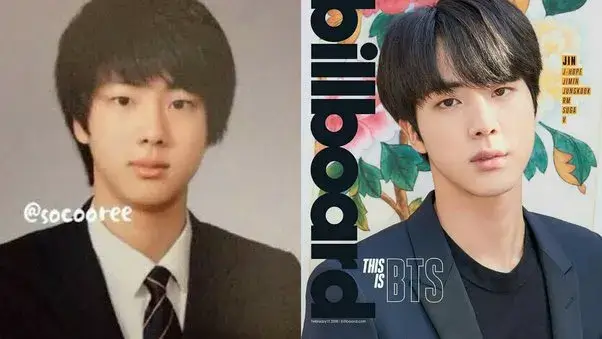 BTS' Jin Plastic Surgery (Before and After)