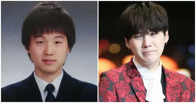 BTS' Suga Plastic Surgery (Before and After)