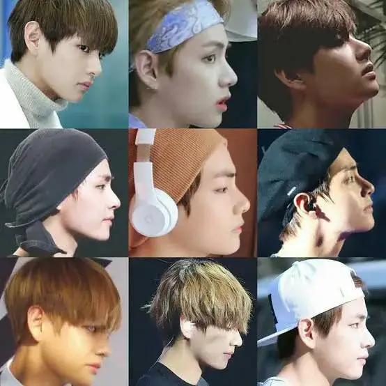 BTS' V Plastic Surgery (Before and After)
