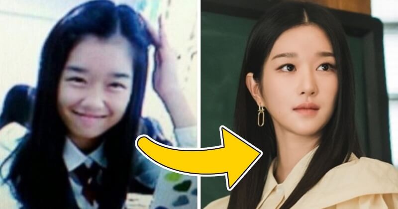 Seo Ye-ji’s Plastic Surgery