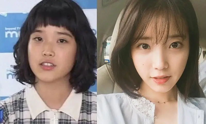 Here are IU’s photos before and after the diet
